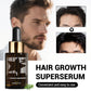 Men’s White Hair Growth Oil for Dense 30ml Black Essence - Teleplus dense hair