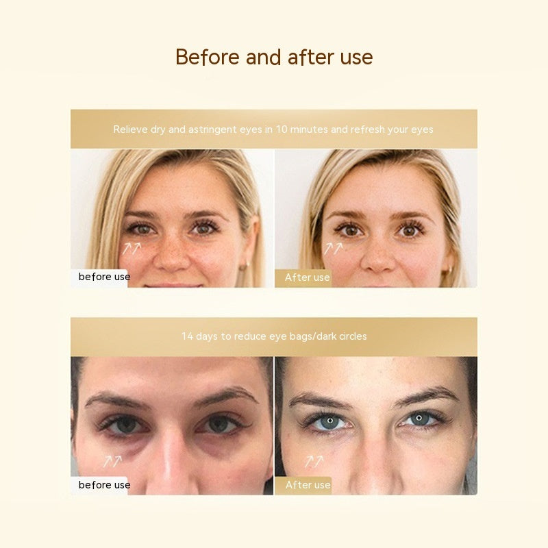 Waterproof Gel Eye Pad for Microcurrent and Treatments - Magic Perky Panda Eyes microcurrent gel eye pad