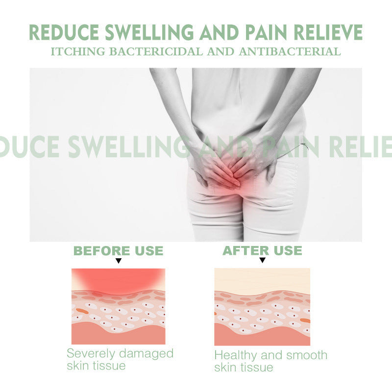 Moisturizing Nursing Cream for Normal and Combination Skin 20g