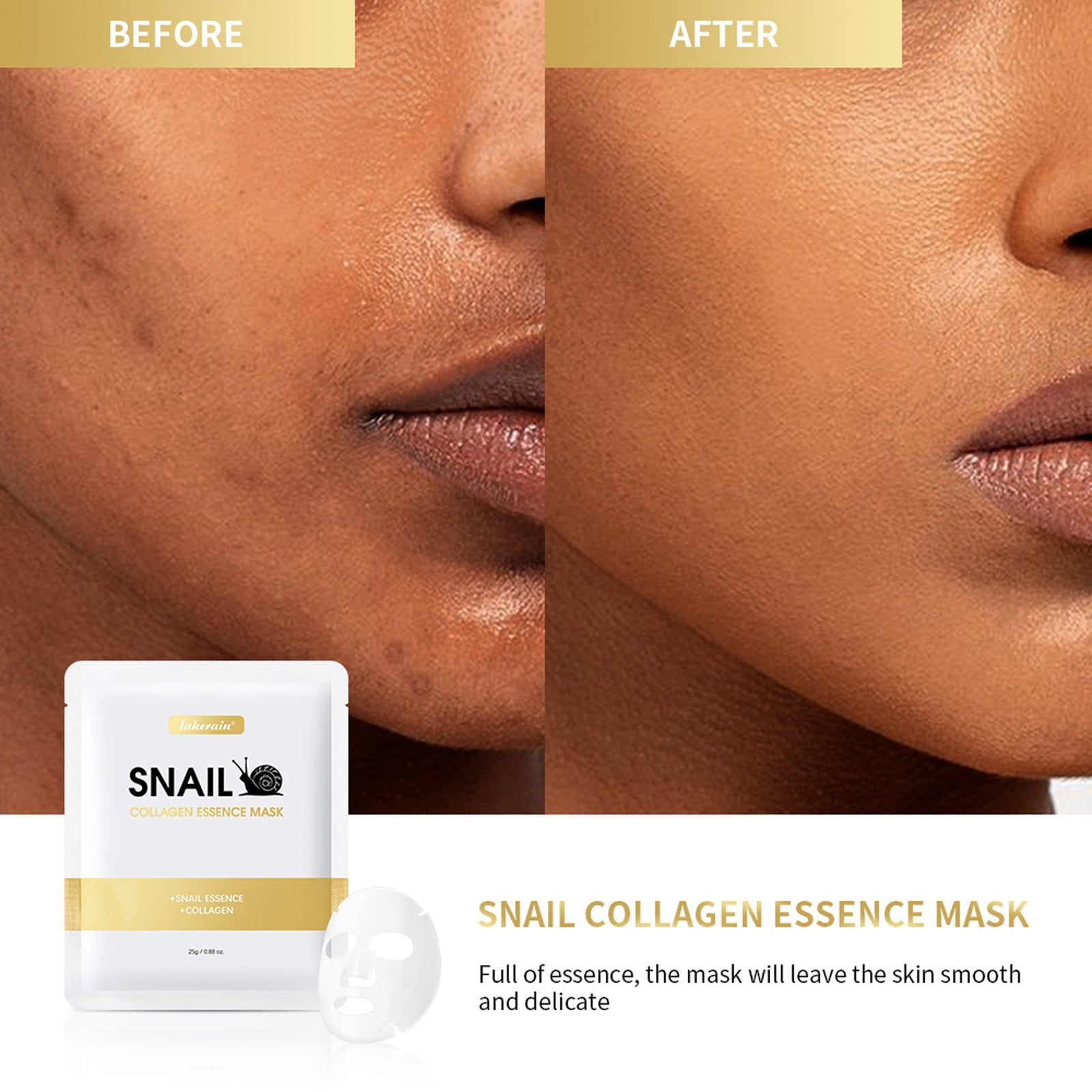 Moisturizing Snail Mask with Blackhead Removal and Oil Control - Teleplus moisturizing snail mask blackhead essence