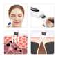 Multifunctional Blackhead And Dead Skin Beauty Equipment - Multifunctional Blackhead and Dead Skin Beauty Wizard