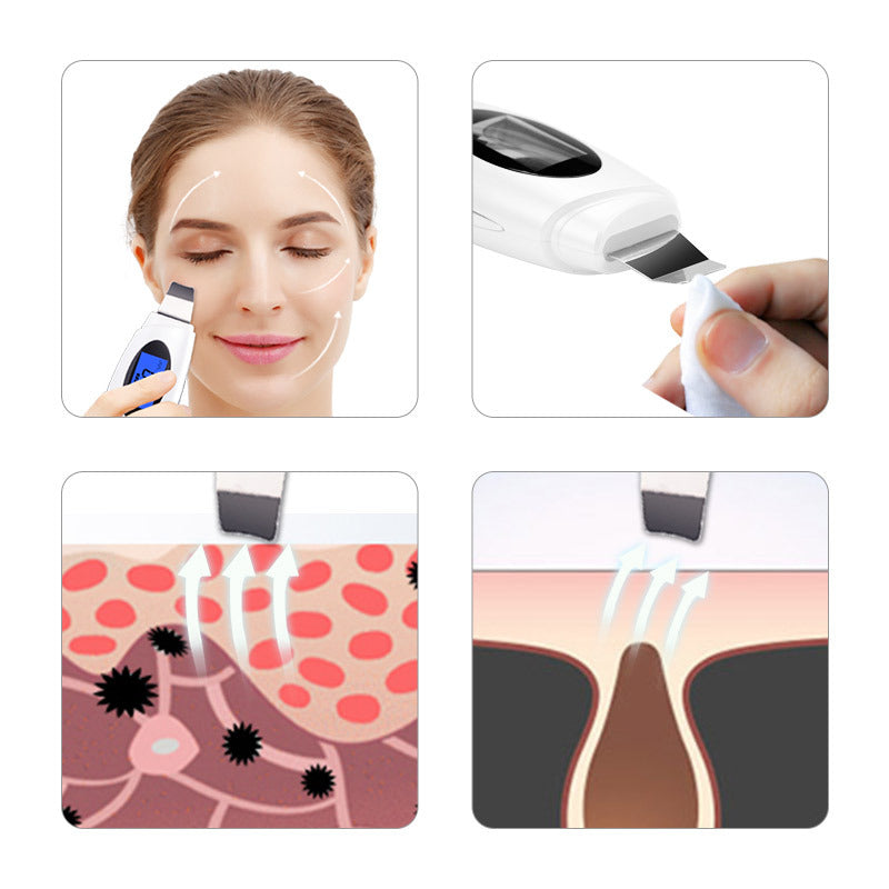 Multifunctional Blackhead And Dead Skin Beauty Equipment - Multifunctional Blackhead and Dead Skin Beauty Wizard