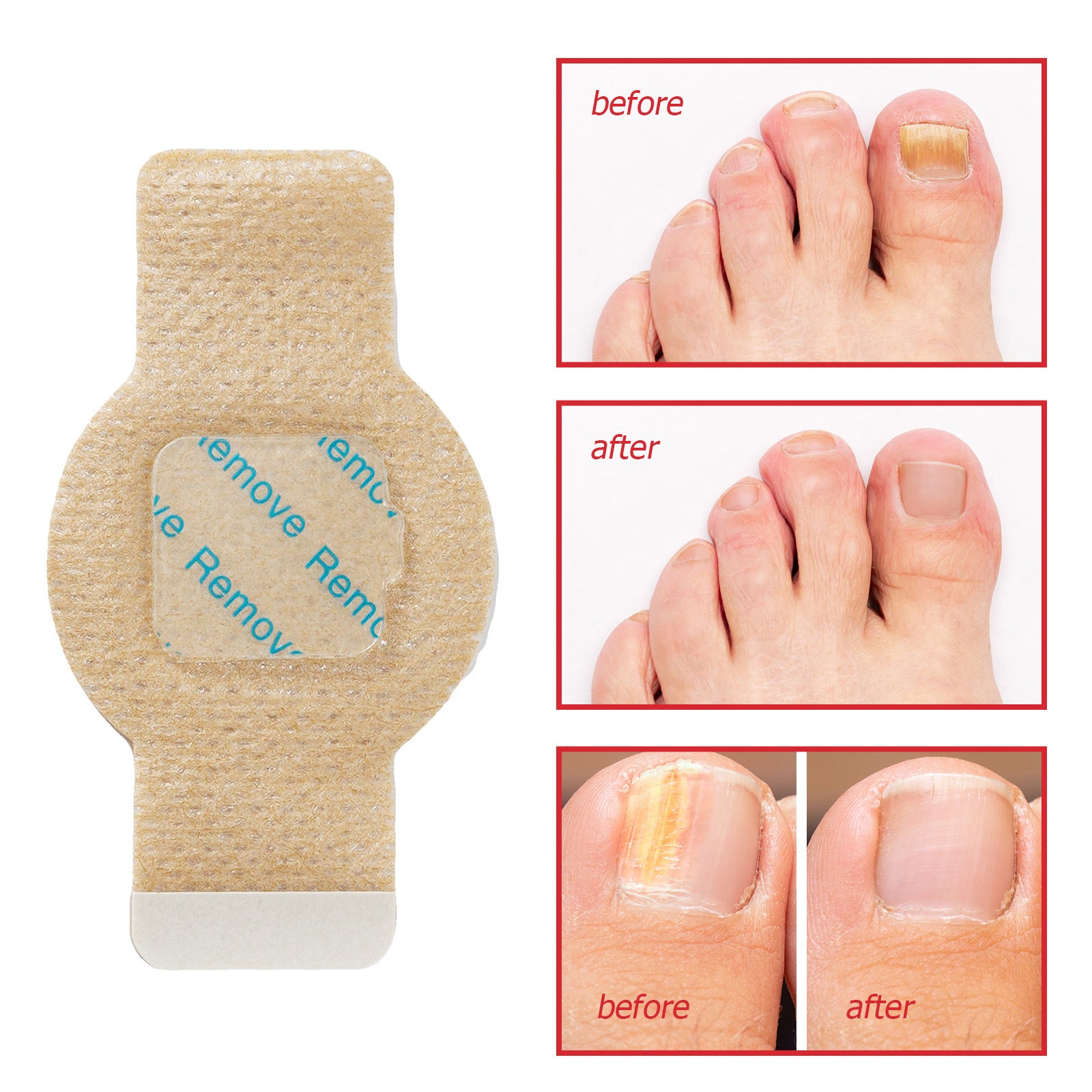 Nail Antibacterial Patch for Strengthening and Repair Healthy Nails - Teleplus nail antibacterial patch strengthening