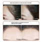 Natural Hairline Decoration Filling Waterproof for Fluffy Enhancement - Teleplus Hair fluffy hairline decoration