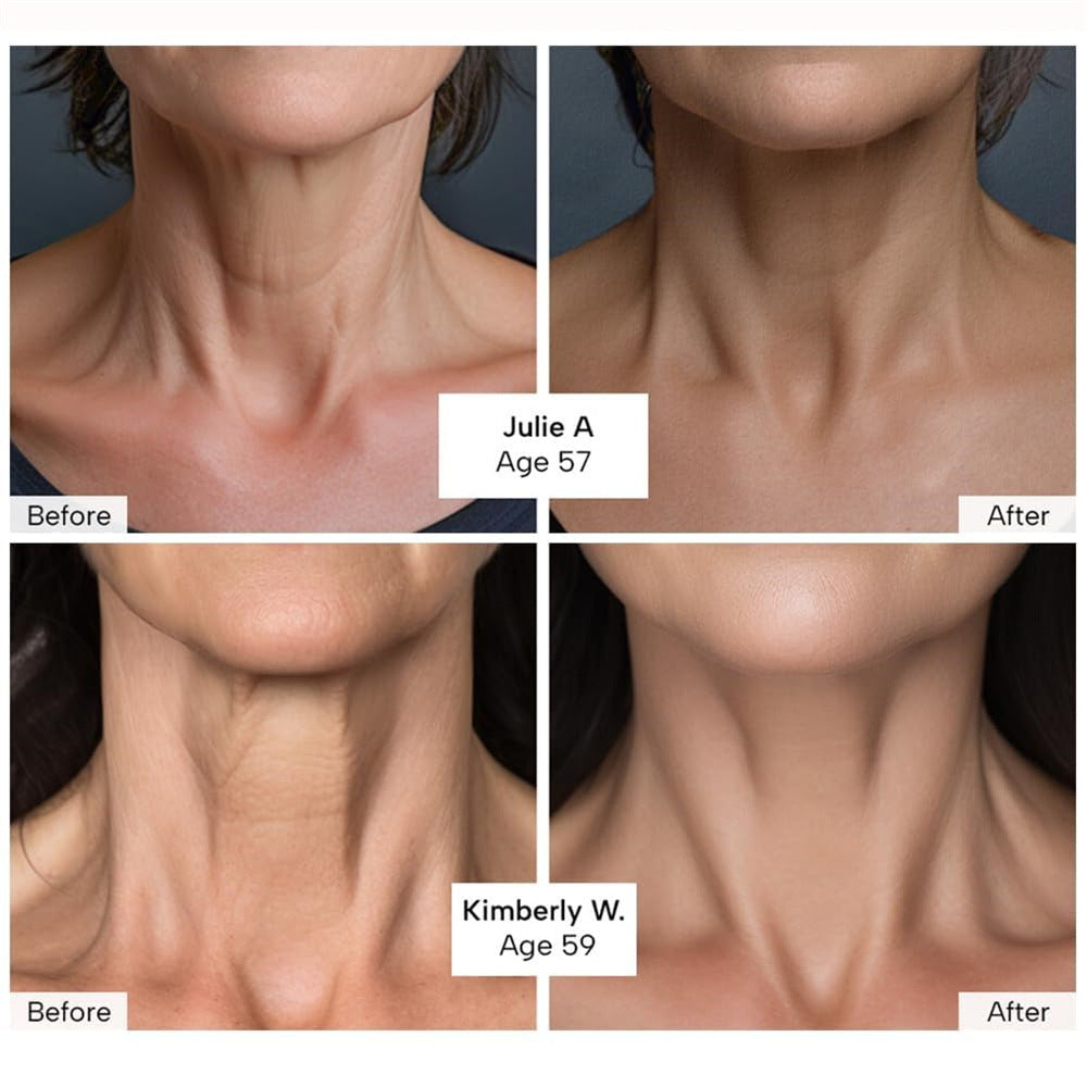 Neck Tightening Cream Firming Moisturizer with Anti-Wrinkle Benefits 30ml - Teleplus neck tightening cream moisturizes