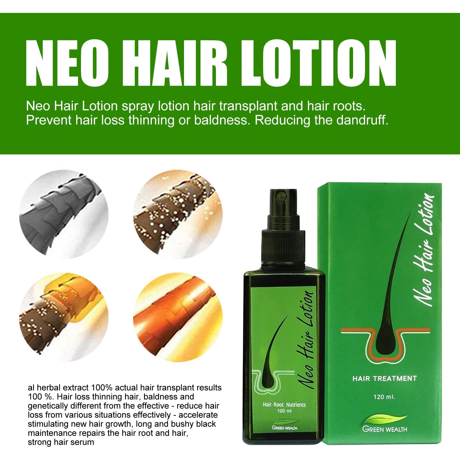 Neo Hair Lotion Serum Natural Spray Oil Kit for Loss Treatment - Teleplus hair loss neo lotion serum product