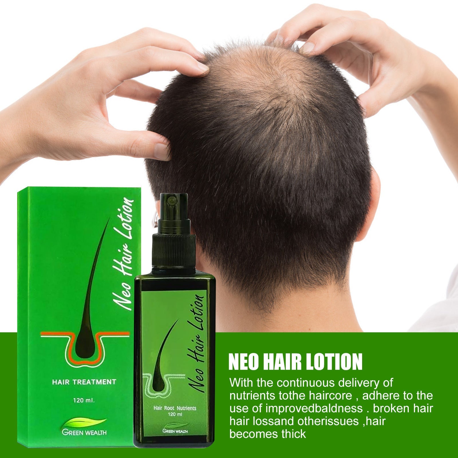 Neo Hair Lotion Serum Natural Spray Oil Kit for Loss Treatment - Teleplus hair loss neo lotion serum product