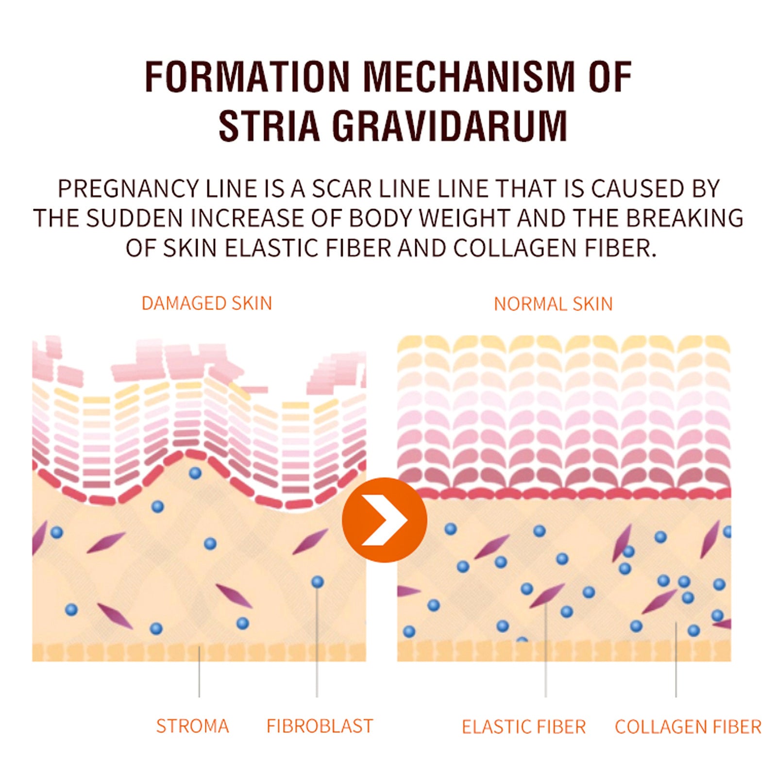 Net 30ml Skin Care Spray for Postpartum Firming and Repair - skin care spray postpartum firming