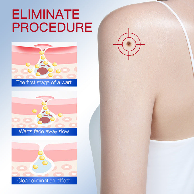 Nevus Removal Pen for Skin Tag and Mole Remover with Facial Essence 2ml