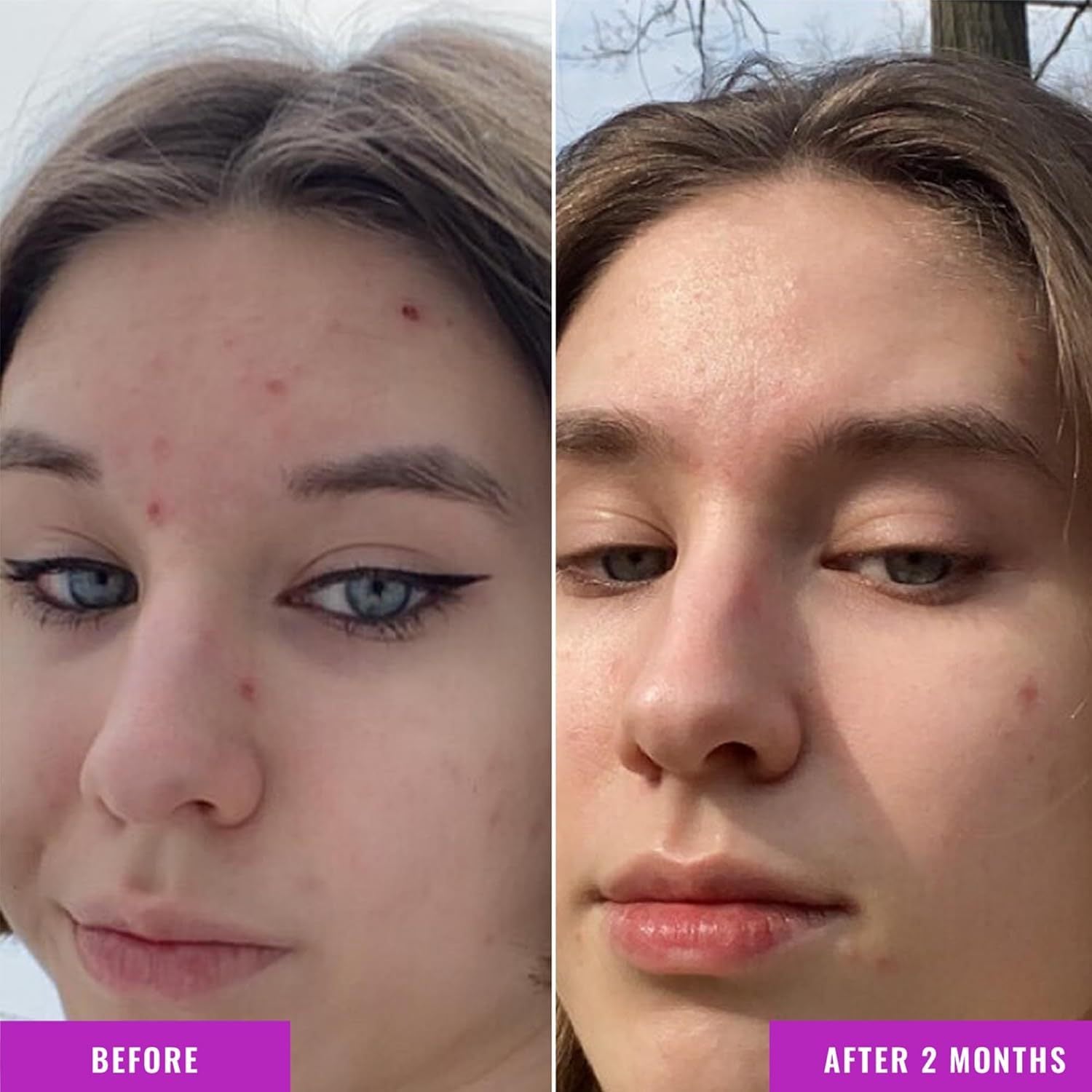 Nicotinamide Balance Facial Essence for Skin Hydration and Clarity 30ml - Teleplus nicotinamide balance facial fluid