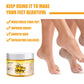 Nursing Care Of Milk Foot Wax Peeling - Get Silky Feet with Milk Foot Wax Peeling Magic