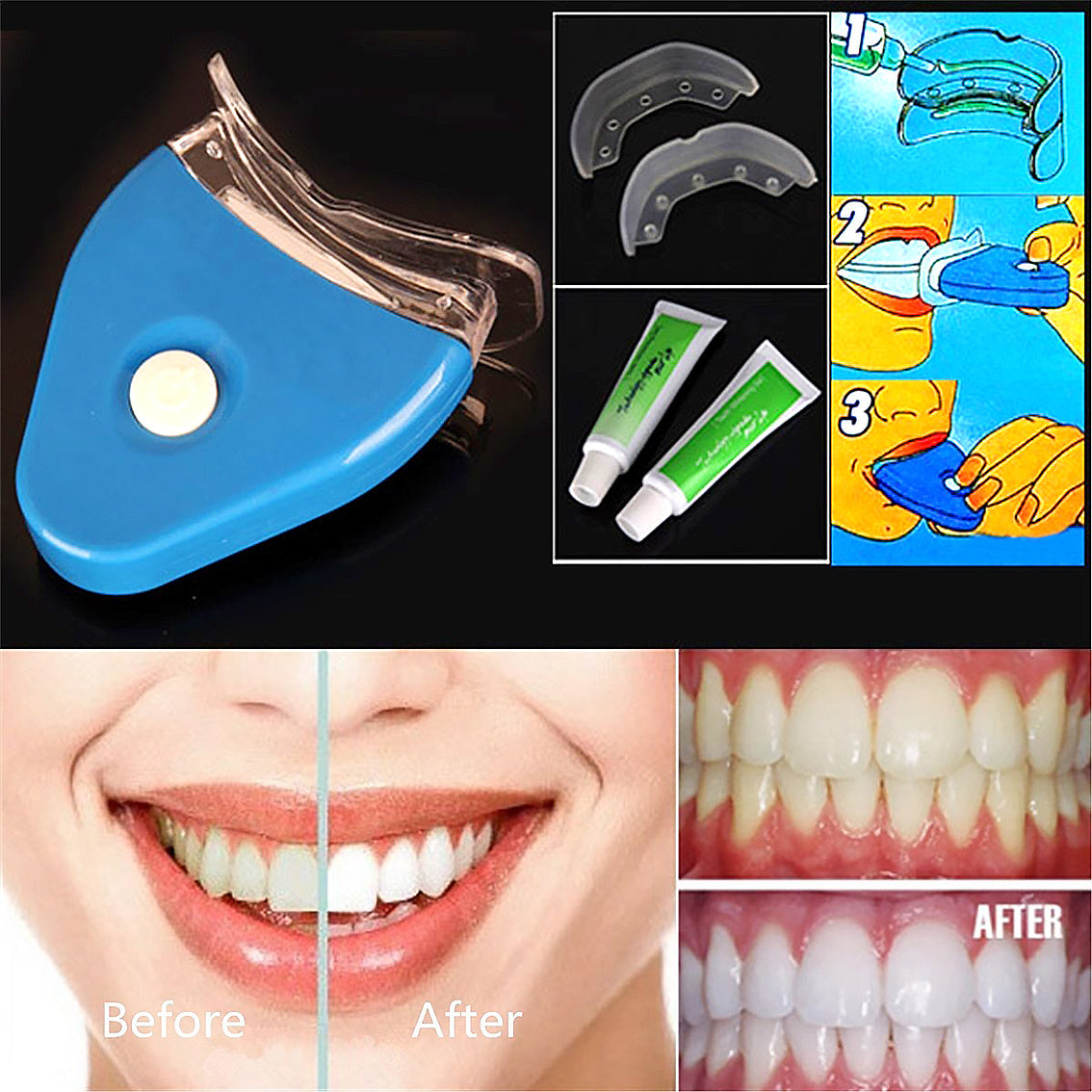 Oral Gel Teeth Tooth Whitening Whitener Dental Bleaching LED - Transform Your Smile with Bright White Transmitter