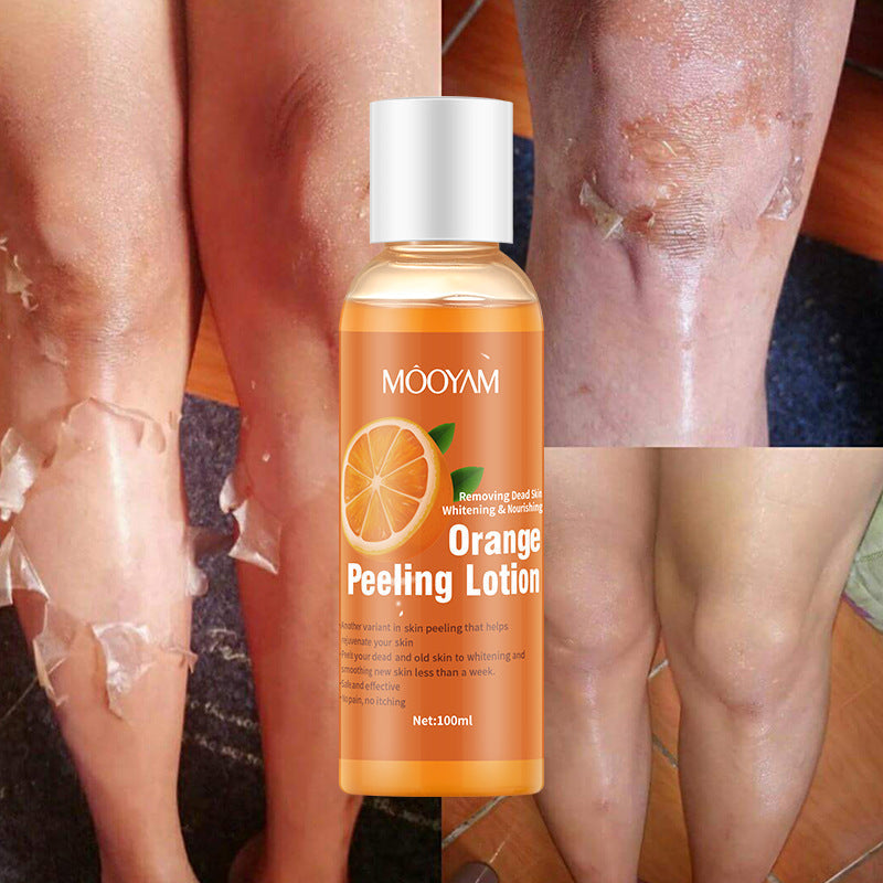 Orange Peel Lotion with Gentle Exfoliation for Skin Renewal 100g - Away Your Worries orange peel lotion gentle
