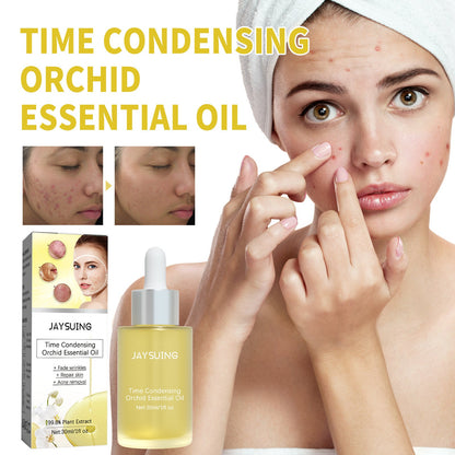 Orchid Acne Treatment Oil with Glycerin and Hyaluronic Acid 30ml - Teleplus orchid acne treatment oil cleansing