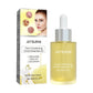 Orchid Acne Treatment Oil with Glycerin and Hyaluronic Acid 30ml - Teleplus orchid acne treatment oil cleansing