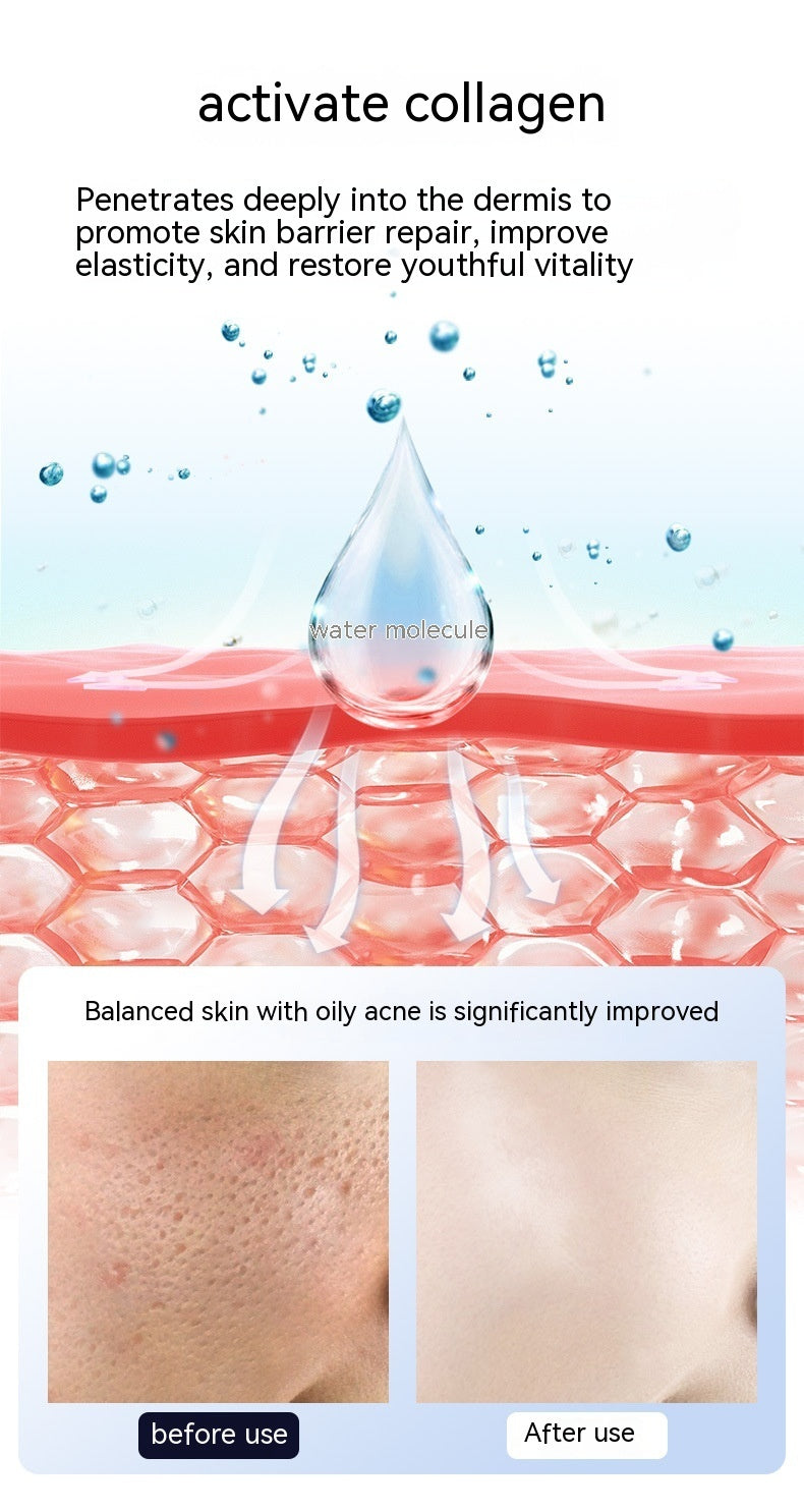 Photon Skin Rejuvenation Handheld Radio Frequency Device for Facial Care - Glow Up with photon skin rejuvenation