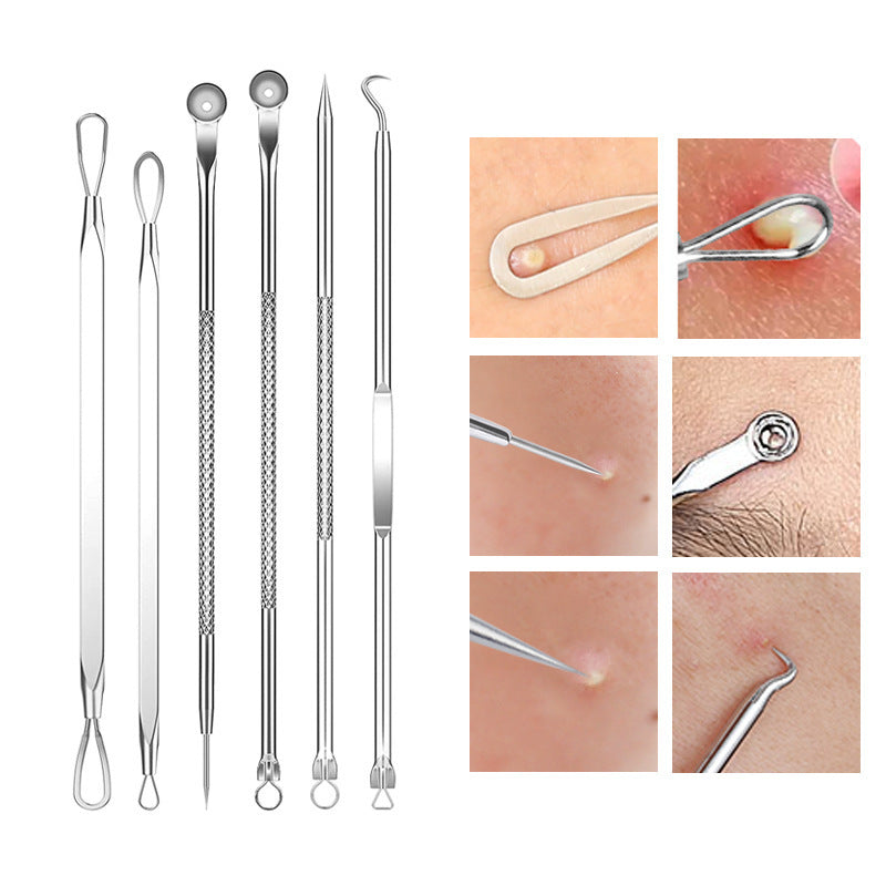 Blackhead and Acne Pimple Removal Tools Set with Cell Tweezer Remover - Eliminate Pimples like a Pro Pin cell tweezer