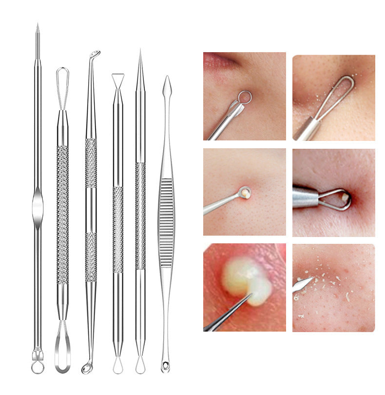 Blackhead and Acne Pimple Removal Tools Set with Cell Tweezer Remover - Eliminate Pimples like a Pro Pin cell tweezer