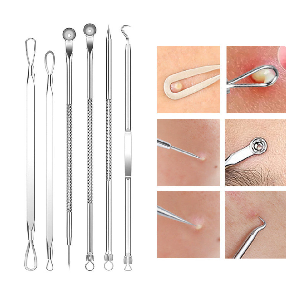 Blackhead and Acne Pimple Removal Tools Set with Cell Tweezer Remover - Eliminate Pimples like a Pro Pin cell tweezer