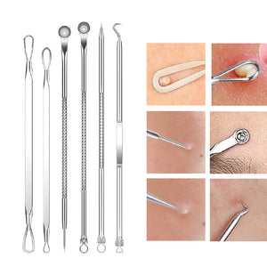 Blackhead and Acne Pimple Removal Tools Set with Cell Tweezer Remover - Eliminate Pimples like a Pro Pin cell tweezer