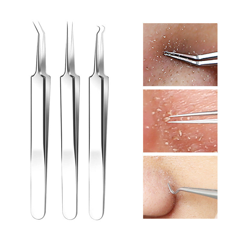 Blackhead and Acne Pimple Removal Tools Set with Cell Tweezer Remover - Eliminate Pimples like a Pro Pin cell tweezer