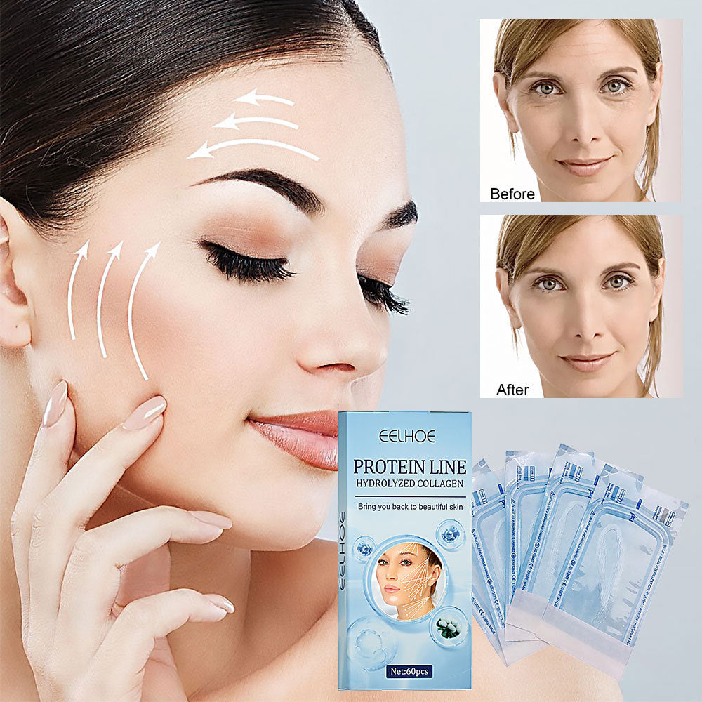 Protein Lifting Line for Face and Skin 120pcs Pack - a That Defies Time protein lifting line skin face