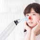 Electric Pore Cleansing Tool for Removing Blackheads and Acne - Battle Absorb Bubbles Perfection remove blackheads