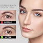 Roller Ball Under Eyes Eye Care - Roller Ball Under Eyes Eye Care for CHF CHF Glow