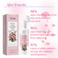 Rose Foam Facial Cleanser for Deep Cleaning with Hyaluronic Acid and Glycerin - rose foam facial cleanser deep cleaning