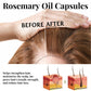 Rosemary Hair Care Capsules with Herbal Extracts to Prevent Loss - Teleplus rosemary hair care capsules prevent loss