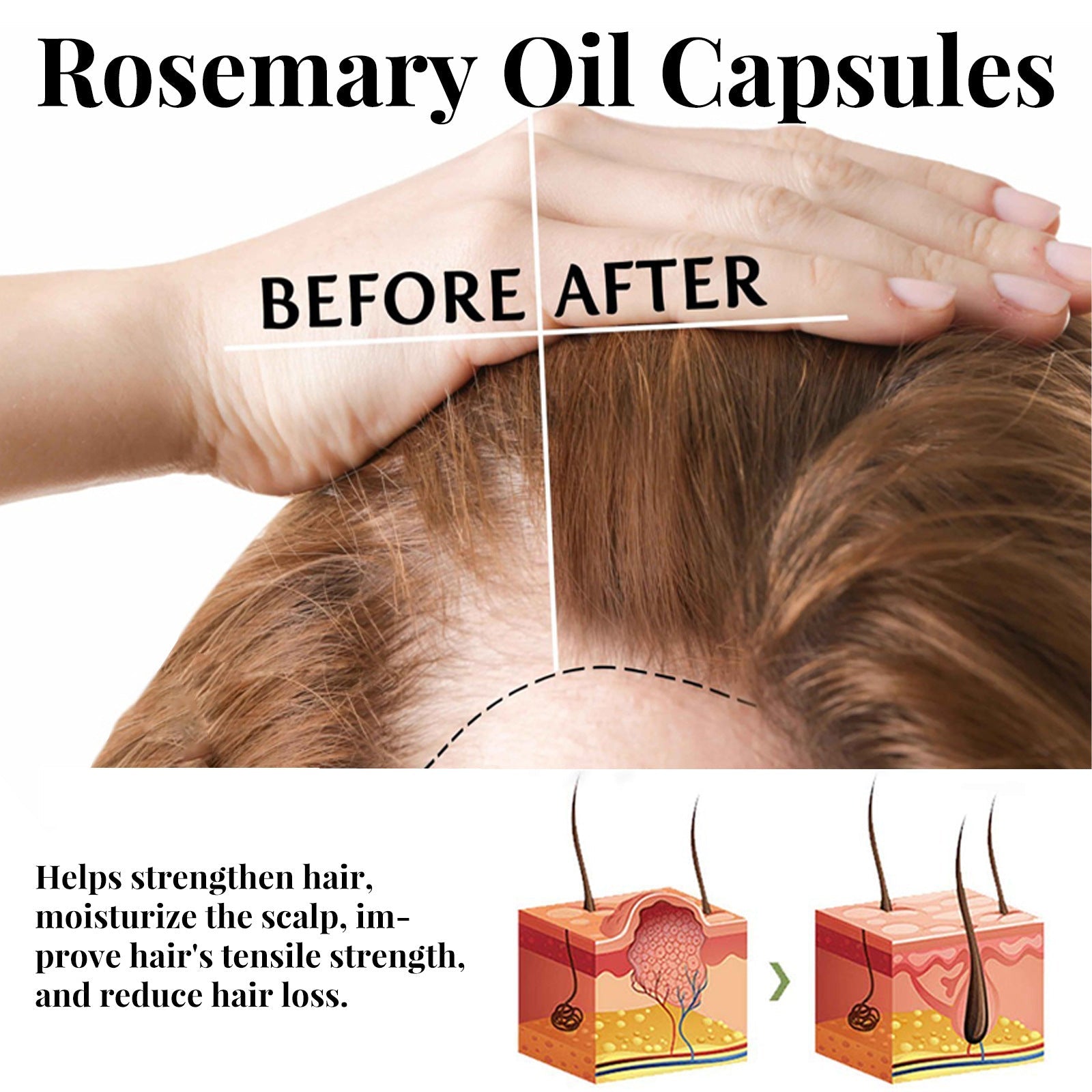Rosemary Hair Care Capsules with Herbal Extracts to Prevent Loss - Teleplus rosemary hair care capsules prevent loss