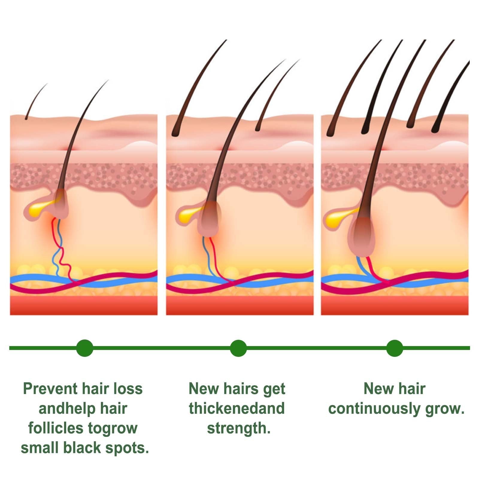 Rosemary Hair Care Capsules with Herbal Extracts to Prevent Loss - Teleplus rosemary hair care capsules prevent loss