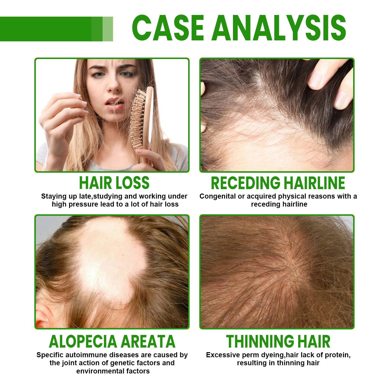 Rosemary Oil for Dense Hair Growth 120ml 155g Spray - Teleplus dense hair