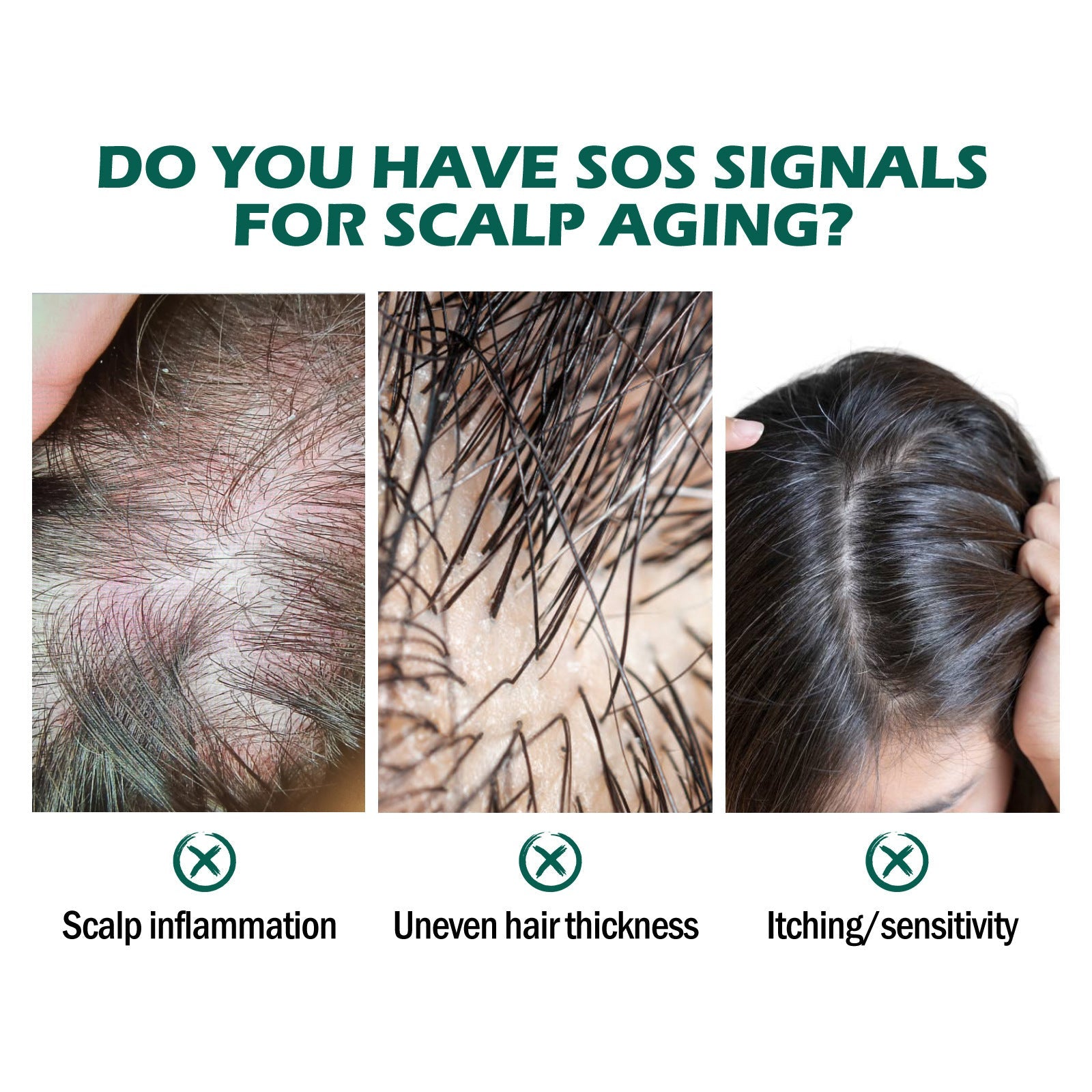 Scalp Hair Care Oil with Grape Seed Ginger Ginseng Peppermint Extract 30ml - scalp hair care grape seed oil ginger