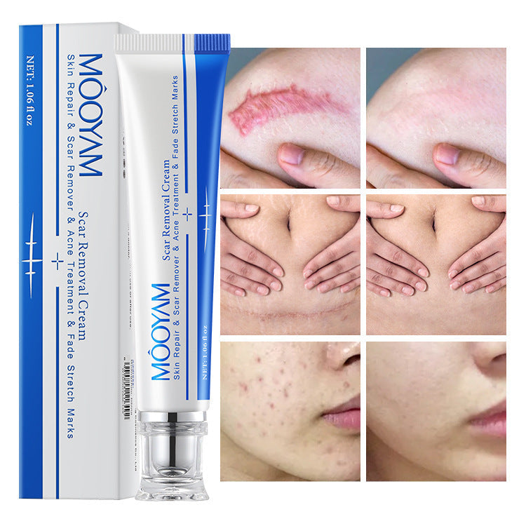 Scar Moisturizing Repair Cream