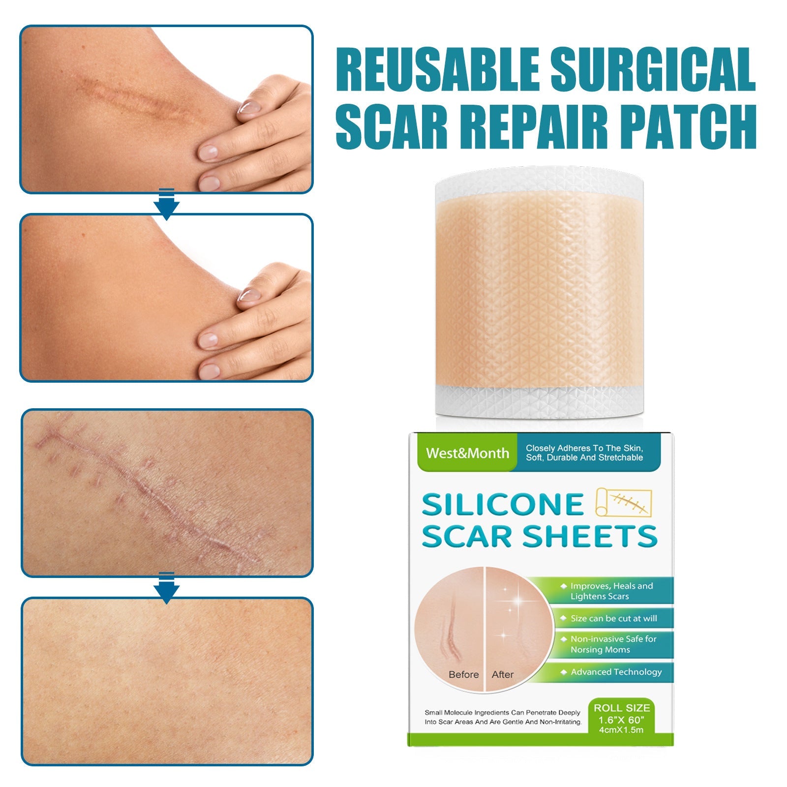 Self-Adhesive Silicone Scar Paster for Repair 1PC Pack - Teleplus silicone scar paster repair self-adhesive
