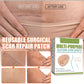 Silica Gel Scar Repairing Stickers for and Skin Restoration - Your Oopsies silica gel scar repairing stickers