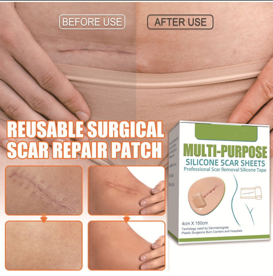 Silica Gel Scar Repairing Stickers for and Skin Restoration - Your Oopsies silica gel scar repairing stickers