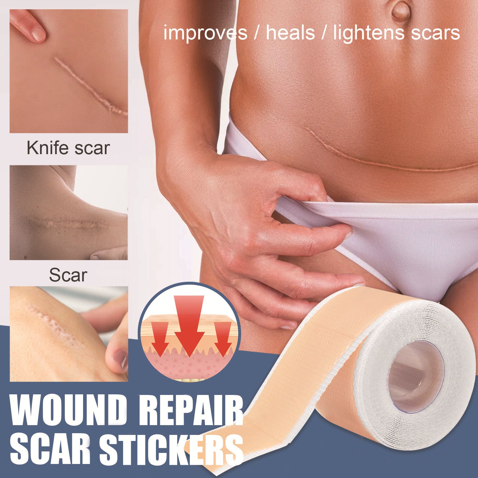 Silica Gel Scar Repairing Stickers for and Skin Restoration - Your Oopsies silica gel scar repairing stickers