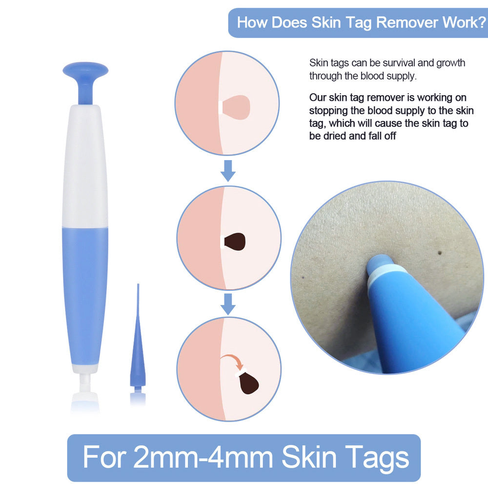 Skin Tag Removal Kit Home Use Mole Wart Remover Micro Band Skin Tag Treatment Tool Easy To Clean Skin Care Tool - Tame