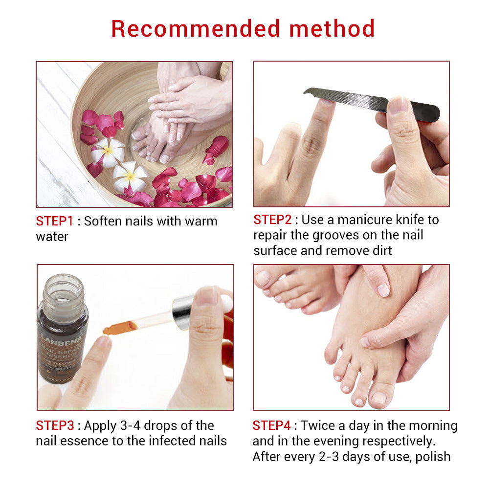 Small File 12ml Nail Care Solution for Home and Professional - Teleplus small file nail care solution applicable place