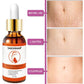 Stretch Mark Remover Essential Oil for Skin Care and Purification - Cream Smooth stretch mark remover essential oil