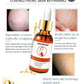 Stretch Mark Remover Essential Oil for Skin Care and Purification - Cream Smooth stretch mark remover essential oil
