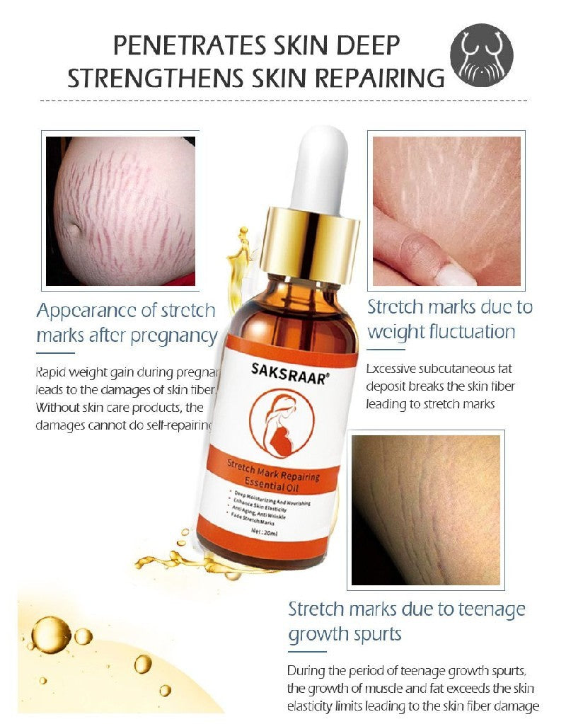 Stretch Mark Remover Essential Oil for Skin Care and Purification - Cream Smooth stretch mark remover essential oil
