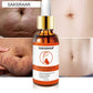 Stretch Mark Remover Essential Oil for Skin Care and Purification - Cream Smooth stretch mark remover essential oil