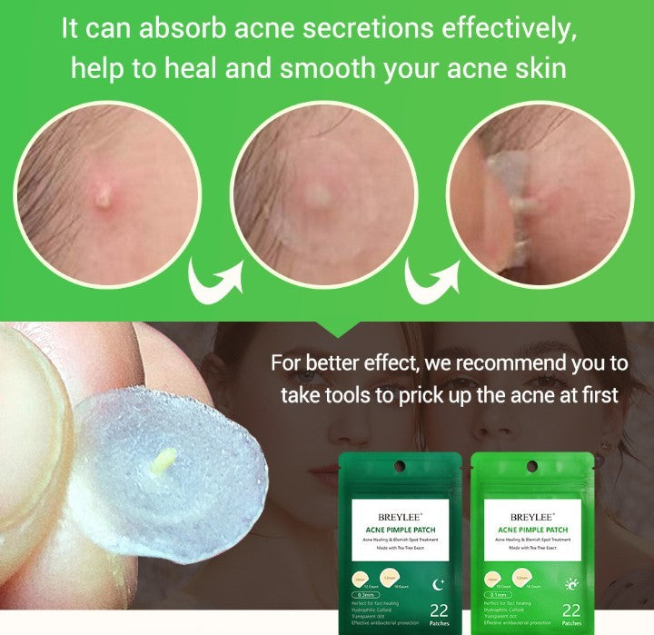 Tea Tree Acne Patch Fades Acne Marks and Ultra-thin - Tea Tree Acne Patch for Sneaky Clear Skin Magic