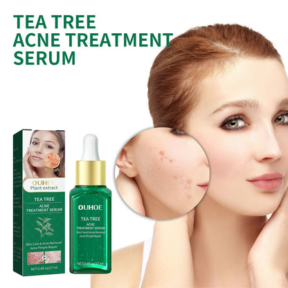 Tea Tree Oil Facial Nursing Solution for Skin Cleaning 17ml - Nourishing tea tree oil facial skin cleaning