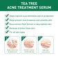 Tea Tree Oil Facial Nursing Solution for Skin Cleaning 17ml - Nourishing tea tree oil facial skin cleaning