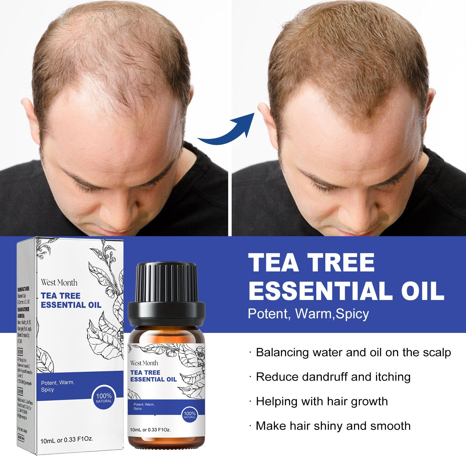 Tea Tree Oil for Nails and Skin Repair 10ml Moisturizing Essence - Teleplus Moisturizer tea tree