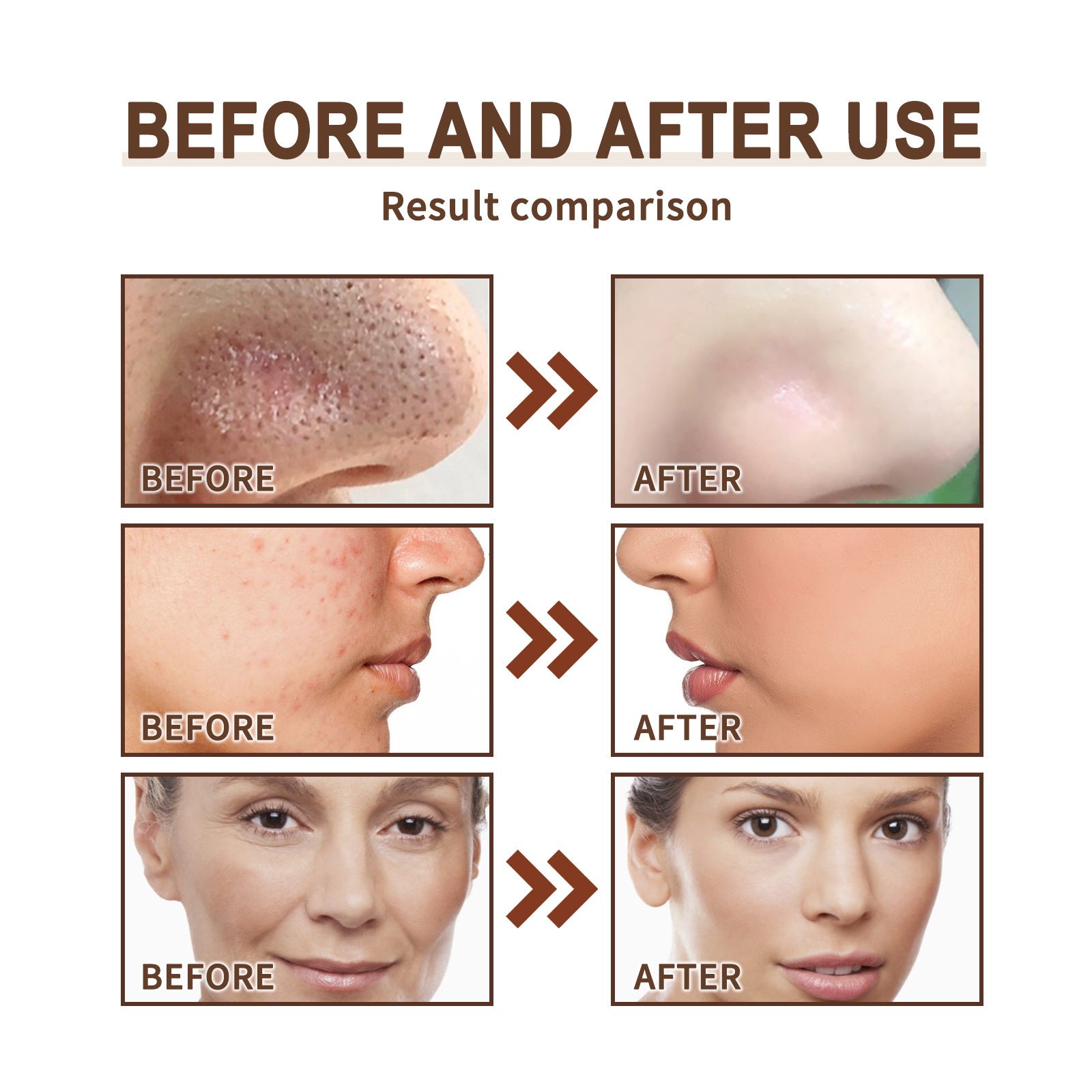 Hydrating Mask for Deep Cleansing Skin and Blackhead Pores 80ml - Tear Away Blackheads with Delight deep cleansing skin